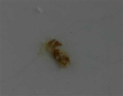 dishwasher residues which is actually burnt on food